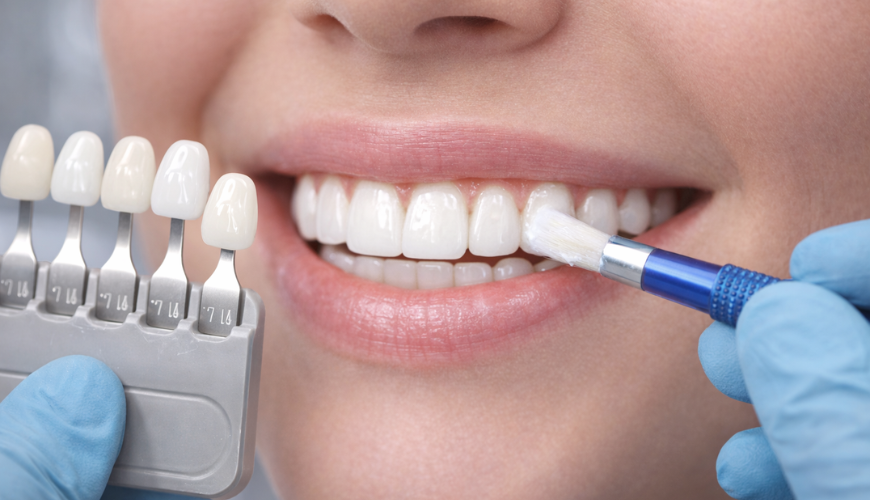 Dental Implants
