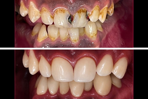 Cosmetic Dentistry