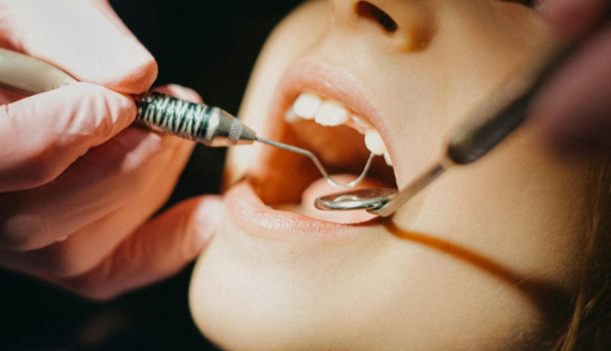 Dental Implants